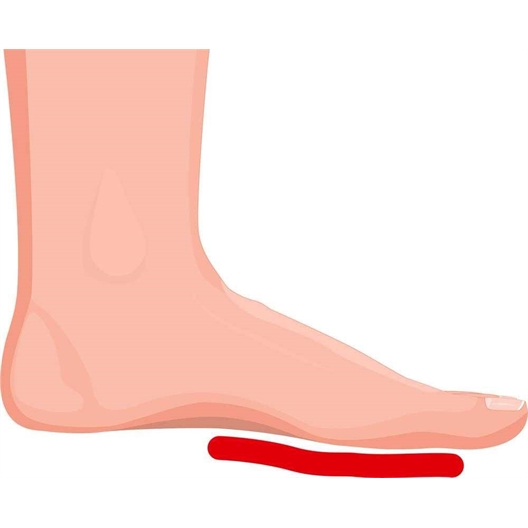 Mémoire de forme : coussinets, protège talons, talonnettes