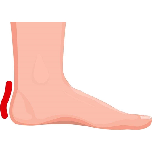 Mémoire de forme : coussinets, protège talons, talonnettes