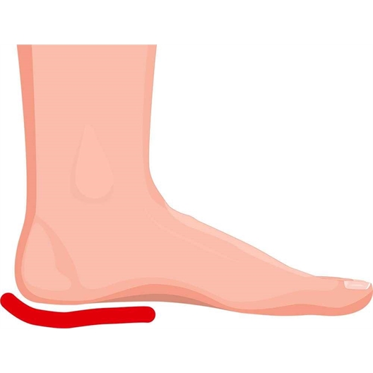 Mémoire de forme : coussinets, protège talons, talonnettes