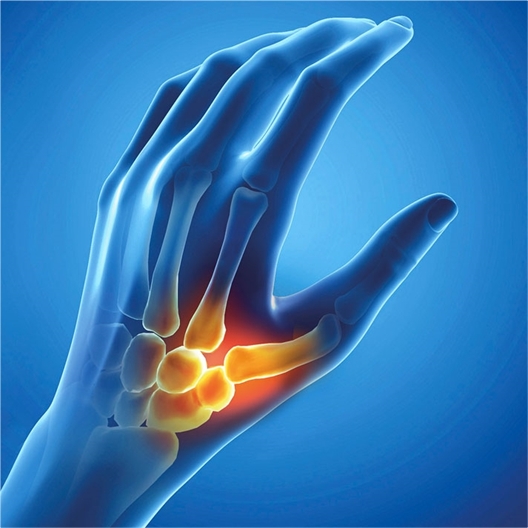 Orthèse pour pouce Epitact® : Droit ou Gauche