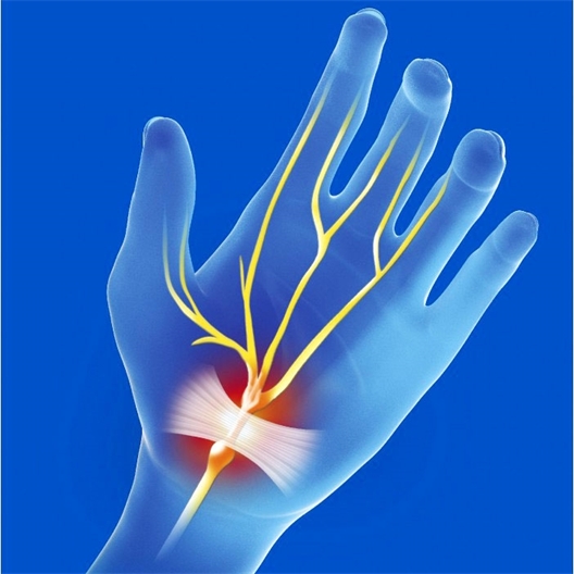 Orthèse poignet droit ou gauche CARP'ACTIV®